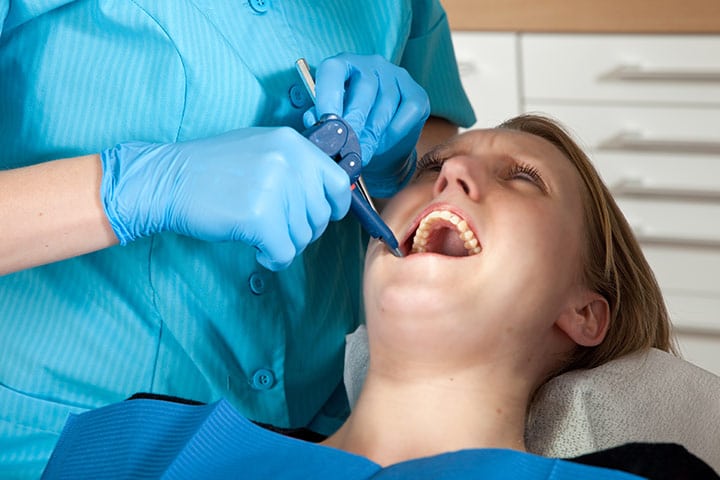 Tooth Extractions Treatment Milwaukee WI